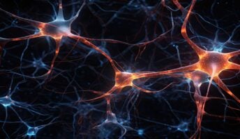 Neural network